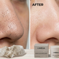 Lanbena Nose Pore Strips