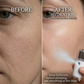 Mist Spray